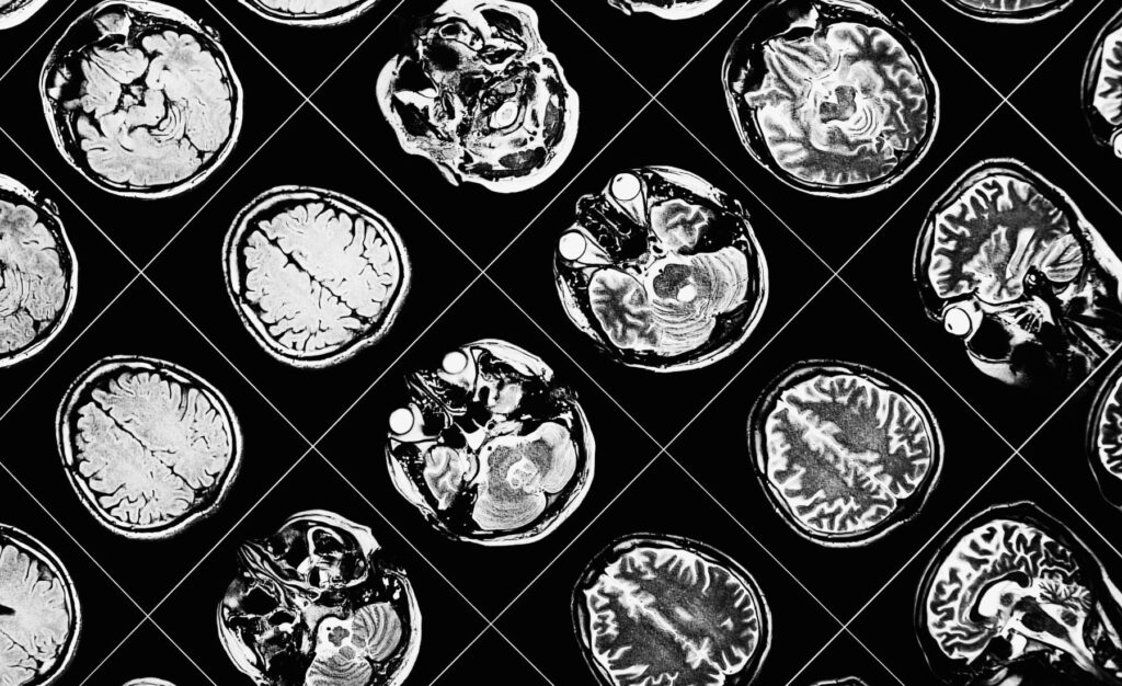 general brain studies